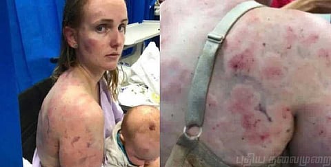 அதிவேக ஆலங்கட்டி மழை... குழந்தைக்காக உயிரைப்பணயம் வைத்த போராளி தாய்!