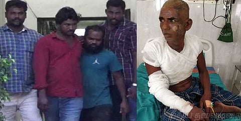 சிகரெட் கொடுக்காததால் முதியவர் தலையில் தீ வைத்த கும்பல் கைது