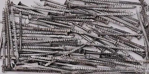 நோயாளி வயிற்றிலிருந்து அகற்றப்பட்ட 122 ஆணிகள்!