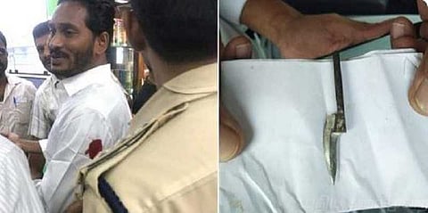 ஜெகன் மோகன் ரெட்டி மீது கூர்மையான ஆயுதத்தால் தாக்குதல்