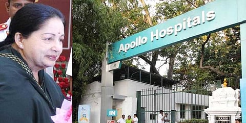 ஜெயலலிதாவுக்கு உடல் உறுப்புமாற்றும் திட்டம் ஏதும் இல்லை !