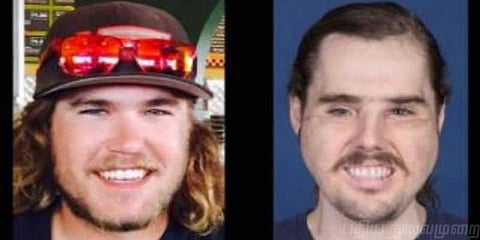 கன்னத்தில் சுட்டுக்கொண்ட இளைஞர் - மீண்டும் வாழ்வளித்த மருத்துவர்கள்