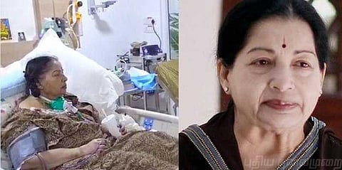 ஜெயலலிதாவுக்கு 75 நாளில் உணவுக்காக ரூ.1.17 கோடி செலவு