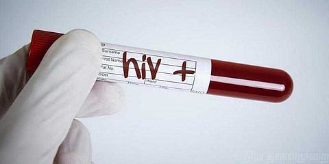 எச்.ஐ.வி ரத்தத்தால் பாதிக்கப்பட்ட கர்ப்பிணிக்கு கூட்டு மருத்து சிகிச்சை