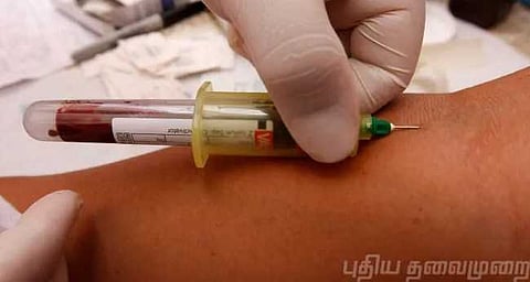 “இன்று தேடுபவர்கள் அன்று ஏன் சொல்லவில்லை?”-எச்.ஐ.வி பாதித்த இளைஞர் கேள்வி