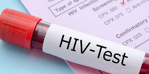 “எச்.ஐ.வி தொற்று ரத்தப் பரிசோதனையில் தெரியாமல் போகலாம்” - மருத்துவரின் விரிவான அலசல்