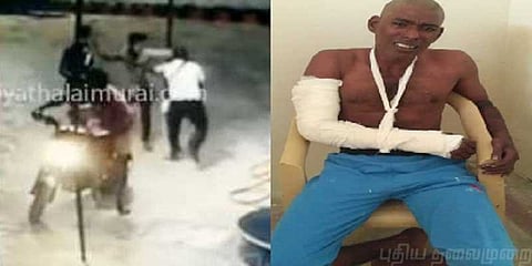 பெட்ரோல் பங்க் கொள்ளை வழக்கு: முக்கிய குற்றவாளியின் கை எலும்பு முறிவு