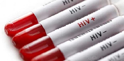 எச்.ஐ.வி ரத்தம் - கர்ப்பிணிக்கு இலவச வீட்டு மனைப் பட்டா