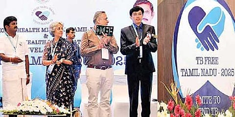 “காசநோய் இல்லாத மாநிலமாக தமிழகம் உருவாக்கப்படும்” - அமைச்சர் விஜயபாஸ்கர்