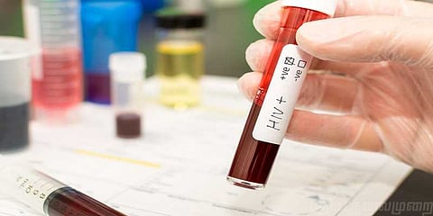 ஹெச்.ஐ.வி ரத்தம்: மேலும் ஒரு பெண் புகார்