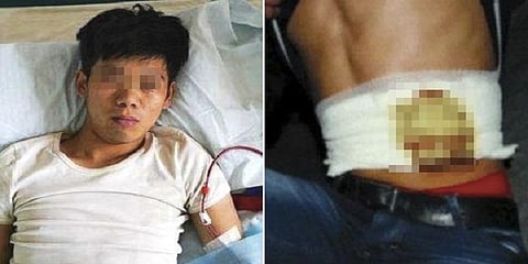 ஐஃபோனுக்காக கிட்னியை இழந்து அவதிப்படும் இளைஞர்