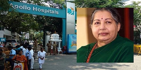 ஜெயலலிதாவுக்கு ஆஞ்சியோ செய்திருக்க வேண்டுமா ? மருத்துவர்கள் சொல்வது என்ன ?