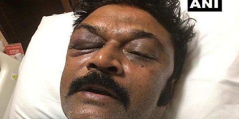 கர்நாடகா காங்கிரஸ் எம்.எல்.ஏக்கள் அடிதடி: போலீசார் வழக்குப்பதிவு