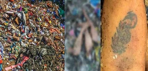 குப்பை கிடங்கில் கிடந்த கை, கால்கள் யாருடையது..? துப்பு துலங்காததால் திணறும் போலீஸ்..!