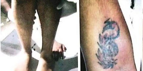 குப்பையில் கிடந்த பெண்ணின் கை, கால் யாருடையது ? - நெருங்கும் காவல்துறை..!