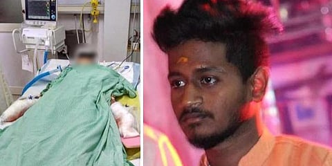 17 முறை கத்தியால் குத்தப்பட்ட ஆந்திர மாணவிக்கு 7 மணிநேர அறுவைச்சிகிச்சை