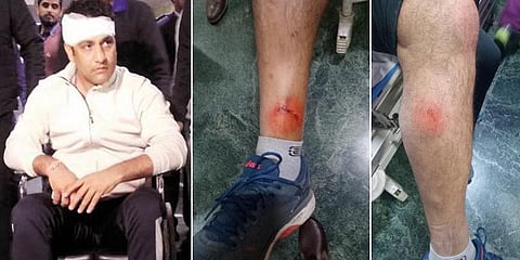 பண்டாரி மீதான தாக்குதல் கோழைத்தனமானது: சேவாக், தவான், காம்பீர் கடும் கண்டனம்!