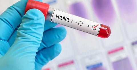 தெலங்கானாவில் இதுவரை 496 பேர் பன்றிக் காய்ச்சலால் பாதிப்பு..!