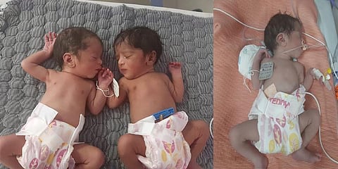 மகளிர் தினத்தன்று ஒரே பிரசவத்தில் பிறந்த 3 பெண் குழந்தைகள் !