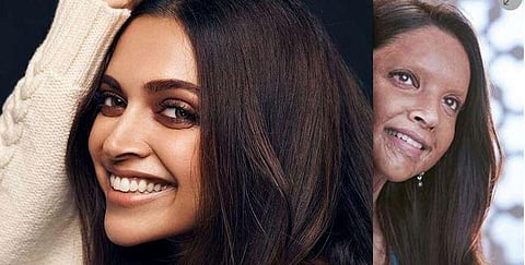 ஆசிட் வீசப்பட்டப் பெண்ணாக மாறிய தீபிகா: வைரலான பர்ஸ்ட் லுக்!