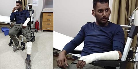 துருக்கியில் நடந்த ஷூட்டிங்கில் விஷால் படுகாயம்: நடந்தது என்ன?