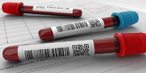 ''கர்ப்பிணிகளின் உயிரிழப்புக்கு அசுத்த ரத்தம் காரணமல்ல'' - ஆய்வுக்குழு அறிக்கை