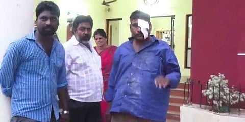 குடிபோதையில் ஓட்டுநரின் கண்ணை பாட்டிலால் குத்திக் கிழித்த சக ஓட்டுநர்