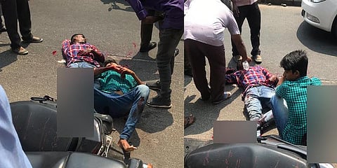 பட்டப் பகலில் அரிவாளால் வெட்டிய கும்பல் - கோவையில் பரபரப்பு