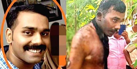 பெண் போலீசை நடு ரோட்டில் தீ வைத்து எரித்துக் கொன்றவர் உயிரிழப்பு