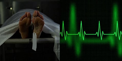 உடற் கூராய்வுக்கு கொண்டு சென்றபோது அசைந்த முதியவர்! - அதிர்ச்சியான மருத்துவர்கள்!