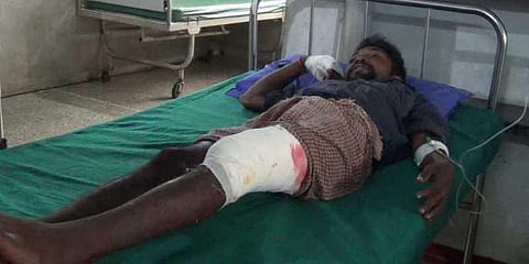 தேன் எடுக்க சென்று கரடியிடம் சிக்கிய இளைஞர் !