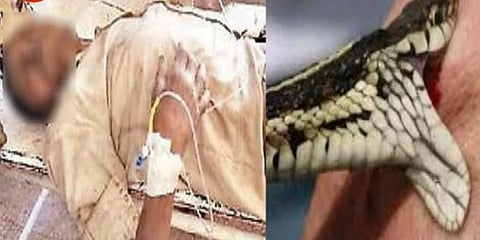 மாறி மாறி கடித்துக்கொண்ட மனிதனும் பாம்பும் - இரு உயிரும் பலி