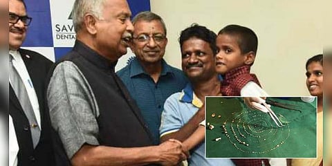 7 வயது சிறுவனின் வாயில் 526 பற்கள்!