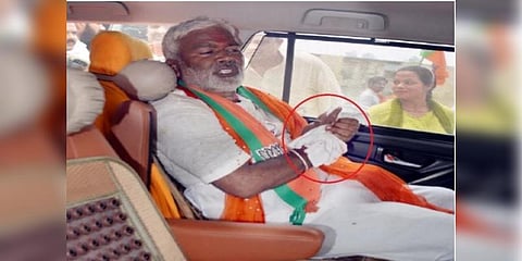 பாஜக அமைச்சர் கை விரல் துண்டானது: ஒட்ட வைக்க முடியாததால் சோகம்!