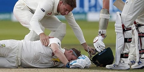 தலையில் பந்து அடித்ததில் மூளையில் பிரச்னை : ஸ்மித் விலகல்