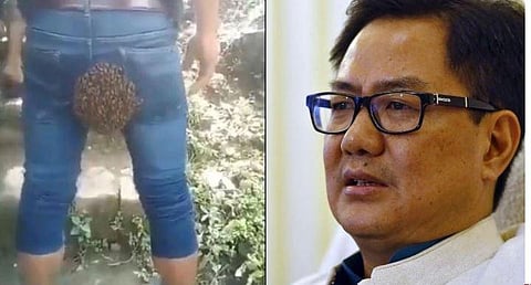 தேன் கூட்டை பின்பக்கம் சுமந்து கொண்டு திரியும் விநோத மனிதர்