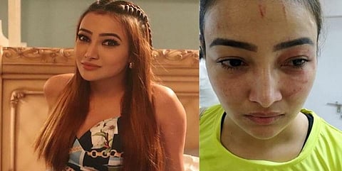 நடிகை நளினி நேகி மீது சரமாரி தாக்குதல் - போலீசார் வழக்குப்பதிவு