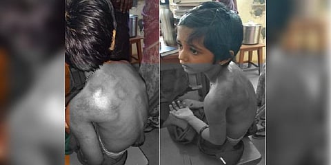 சிறுமியை கொடூரமாக தாக்கிய ‘டியூசன் டீச்சர்’ கைது