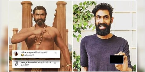 ஏன் இவ்வளவு ஒல்லி? ’பாகுபலி’ ராணாவுக்கு என்னாச்சு?