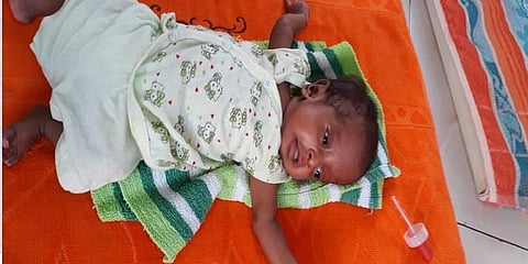 5 மாத போராட்டம்; 500 கிராம் எடையுடன் பிறந்த குழந்தையின் உயிர் காத்த மருத்துவர்கள்!