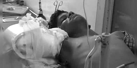 நூற்பாலை இயந்திரத்தில் சிக்கி துண்டான ஊழியரின் ‘கை’