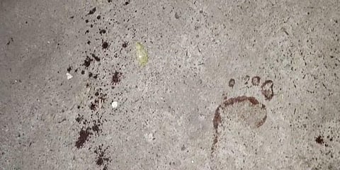 ரயில் நிலையத்தில் இளைஞருக்கு அரிவாள் வெட்டு - சிதறியடித்து ஓடிய பயணிகள்