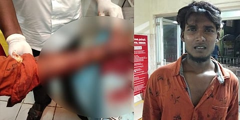 “என் மீது புகார் அளித்தால் செத்துவிடுவேன்” - காவல்நிலையம் முன்பு கையை அறுத்துக்கொண்ட கணவர்