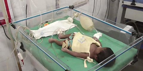 தடுப்பூசி போட்டதால் குழந்தை உயிரிழந்ததாக புகார் - மருத்துவமனையை முற்றுகையிட்ட உறவினர்கள்