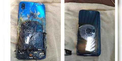 திடீரென வெடித்த ஸ்மார்ட்போன் - வாடிக்கையாளரே காரணம் என ஜியோமி விளக்கம்