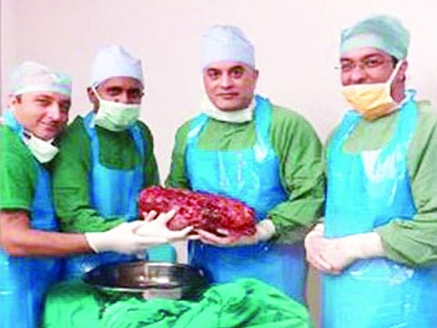 7.4 கிலோ எடையில் சிறுநீரகம்: வெற்றிகரமாக அகற்றிய மருத்துவர்கள்..!