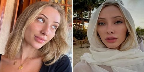 ஒரு புகைப்படம் 10டாலர்: காட்டுத்தீ மீட்புப் பணிக்கு பணம் வசூல் செய்த இன்ஸ்டா மாடல்!