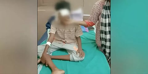 ஆசிரியை அடித்ததால் பறிபோன மாணவனின் கண் பார்வை ?