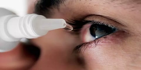 கோடை தொடக்கம்: சென்னையில் அதிகரிக்கும் 'மெட்ராஸ் ஐ ' பாதிப்பு