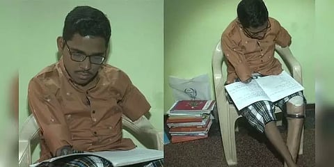 விபத்தில் கைகளை இழந்தார்.. கால்களை இழந்தார்.. ஆனால் நம்பிக்கை இழக்காத இளைஞர்